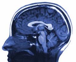MRI brain scan — research profile image