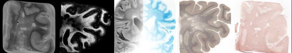 MRI and histology images of brain and spinal cord tissue